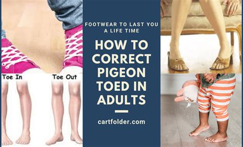 correcting pigeon toe in adults.